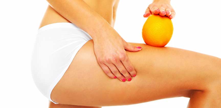 The Truth About Cellulite & Natural Cellulite Treatment
