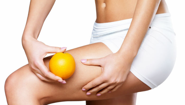 15 Myths and Facts About Cellulite - ABC News